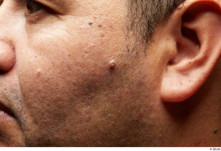 HD face Skin Ian Espinar cheek ear face skin pores…